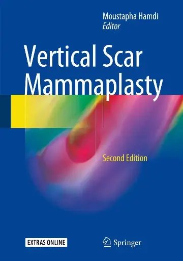  Vertical Scar Mammaplasty 